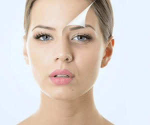 4 vitaminen voor een gezondere huid