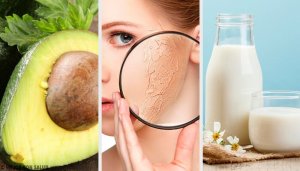 Een droge huid hydrateren met de beste huisremedies