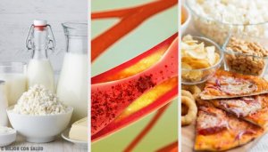 Voedingsmiddelen waardoor je slagaders verstopt raken