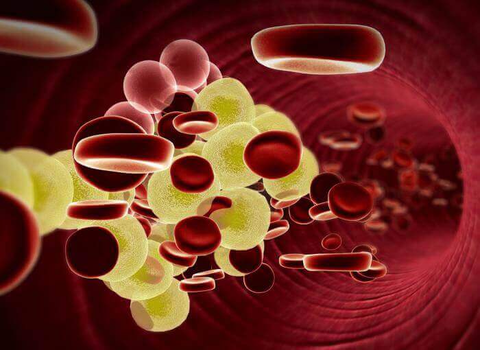 Beheers je slechte cholesterolgehalte 