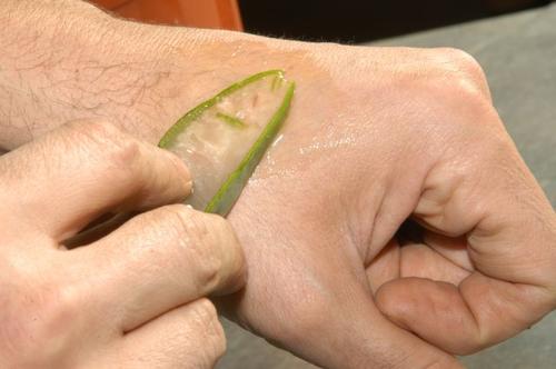 De voordelen van aloëveragel voor de huid: geneest en regenereert
