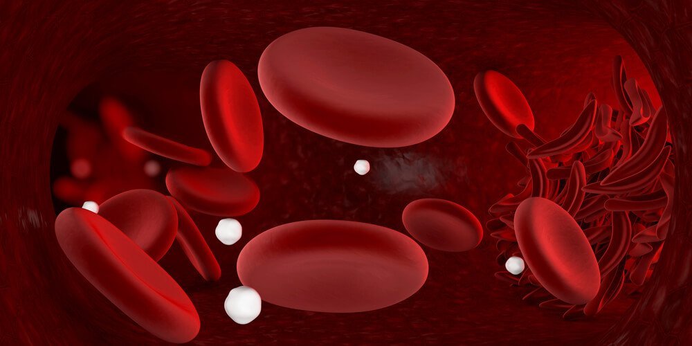 Onfeilbare remedies voor bloedarmoede die je zelf kan maken