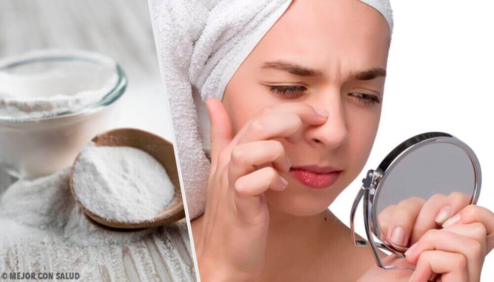 Remedies met baking soda tegen acne