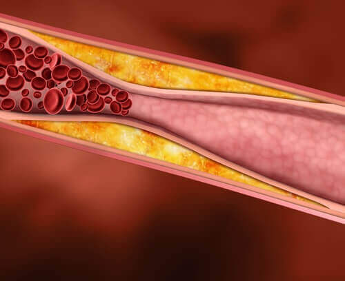 Druivensap is cholesterolverlagend