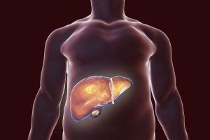 De beste natuurlijke remedies voor de ontgifting van de lever