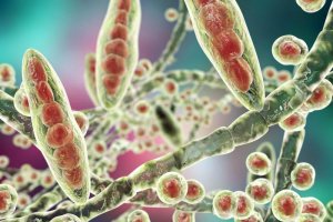 Leer om vervelende voetschimmel te behandelen met deze huismiddelen