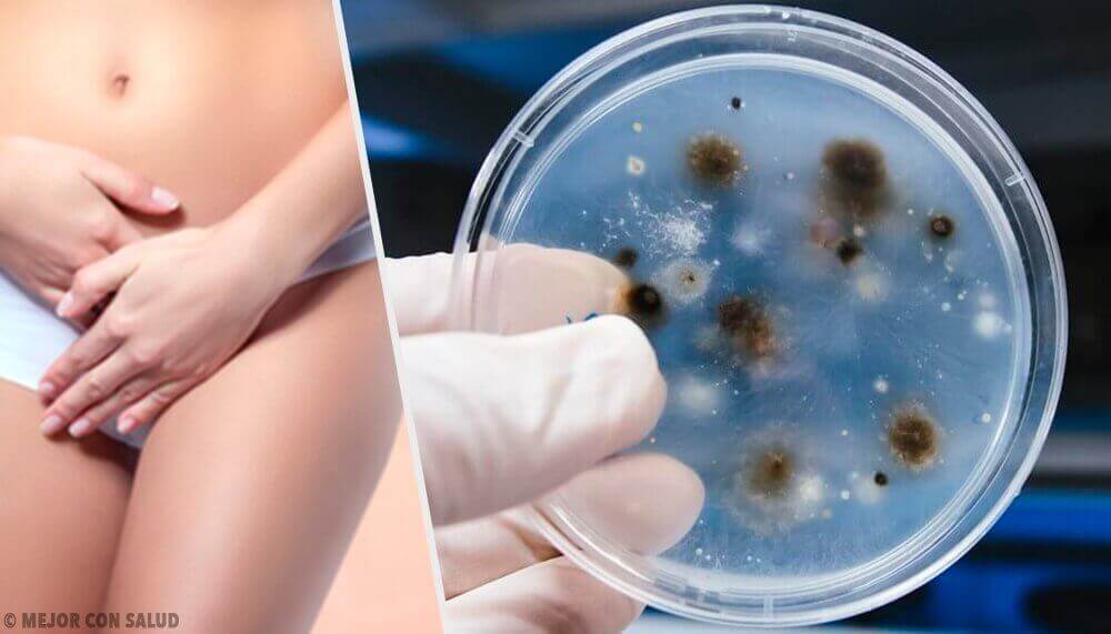 Soorten vaginale infecties en hun oorzaken