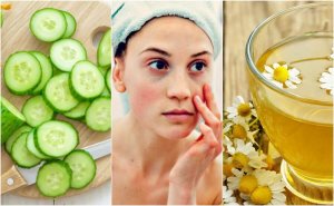 Wallen en donkere kringen verminderen met 5 natuurlijke ingrediënten