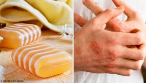 Zelf maken: zeep tegen eczeem, van glycerine, propolis en klei
