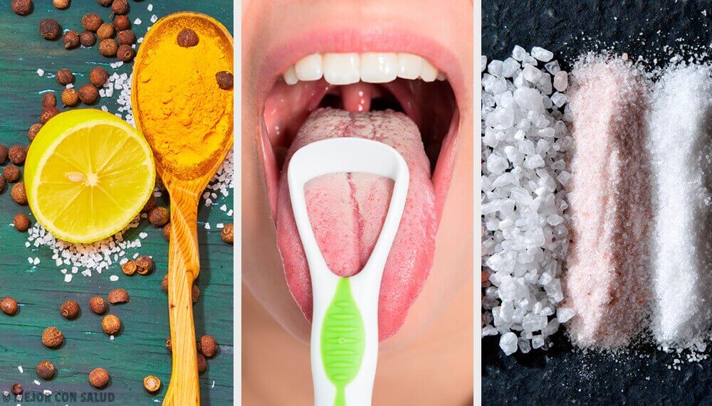 Natuurlijke remedies voor een witte tong