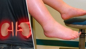 Waardoor kan vochtretentie ontstaan?