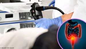 Darmkanker behandelen: alles wat je moet weten