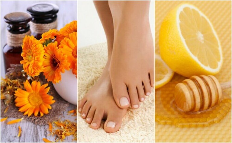 Vijf natuurlijke remedies tegen ingegroeide nagels