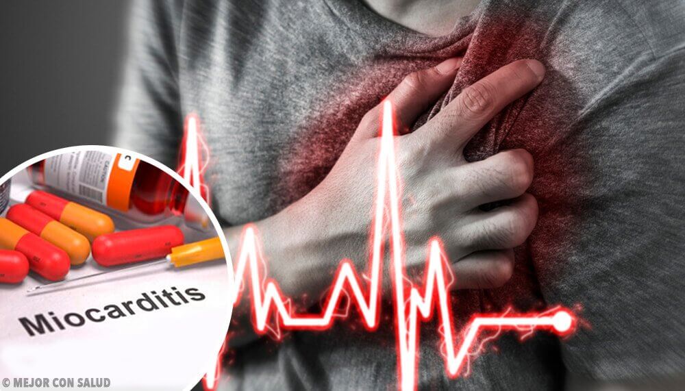 De kenmerken van myocarditis: oorzaken, symptomen, diagnose en behandeling
