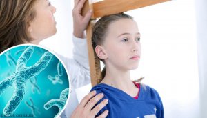 Alles wat je moet weten over het syndroom van Turner