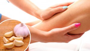 Natuurlijke behandelingen tegen vochtophoping in je lichaam