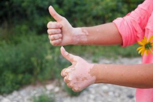 Auto-immuunziekten en de invloed van voeding