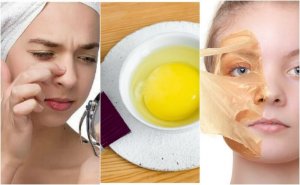 5 maskers van ei om je huid mooier te maken