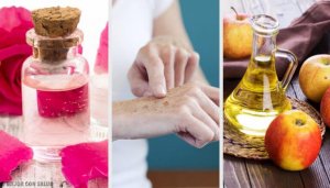 8 natuurlijke manieren om zonnevlekken lichter te maken