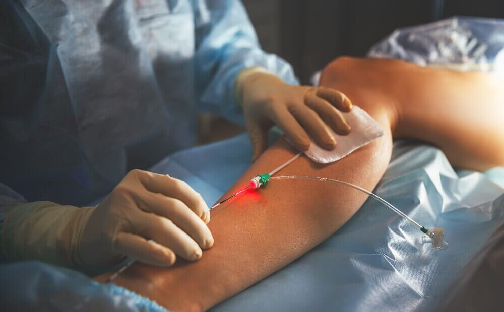 Arts geeft sclerotherapie