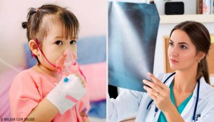 Alles wat je moet weten over de behandeling van een longontsteking