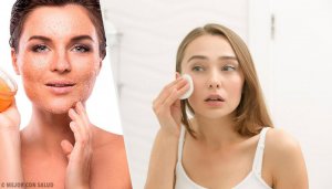 Een droge huid behandelen, voor eens en altijd