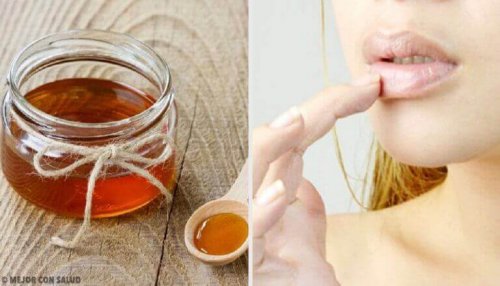 Gebarsten lippen verzorgen met 6 natuurlijke remedies