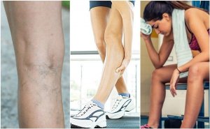 Maak kennis met zes mogelijke oorzaken van spierkrampen