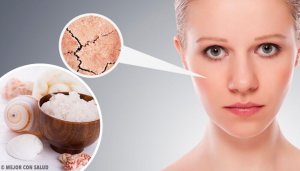 Een eind maken aan een droge huid met 5 natuurlijke remedies