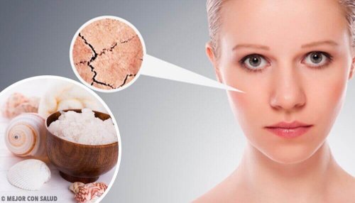 Een eind maken aan een droge huid met 5 natuurlijke remedies