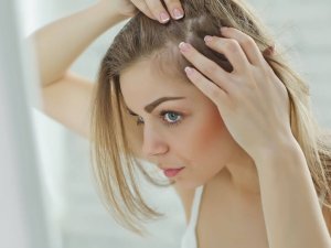 5 natuurlijke remedies om een gevoelige hoofdhuid te verlichten