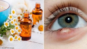 Strontjes behandelen met 5 eenvoudige trucjes