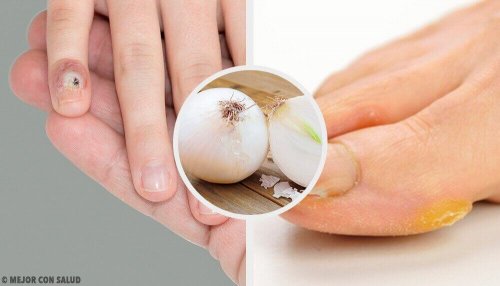 Eelt op je handen en voeten verwijderen met natuurlijke middelen