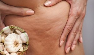 5 manieren om cellulitis te bestrijden