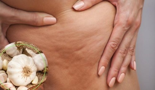 5 manieren om cellulitis te bestrijden