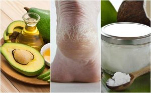 Je gebarsten hielen hydrateren met deze 5 crèmes