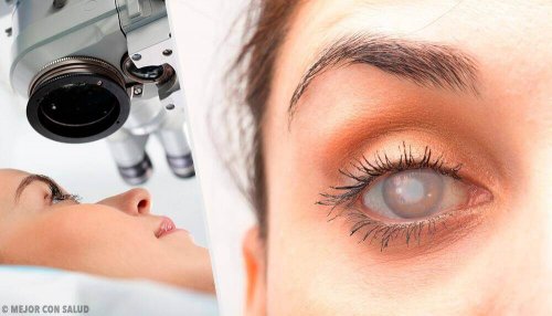 8 symptomen van cataract en hoe deze te verlichten