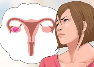 De bijwerkingen van behandelingen voor eierstokkanker