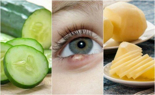 5 natuurlijke oplossingen tegen oogstrontjes