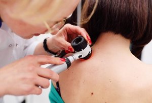 Zijn melanomen de enige ernstige vormen van huidkanker?