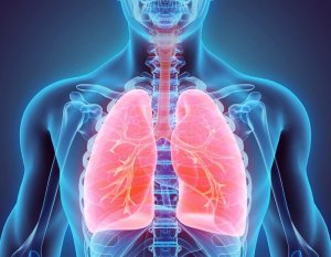 Natuurlijke remedies om bronchiëctasie te bestrijden