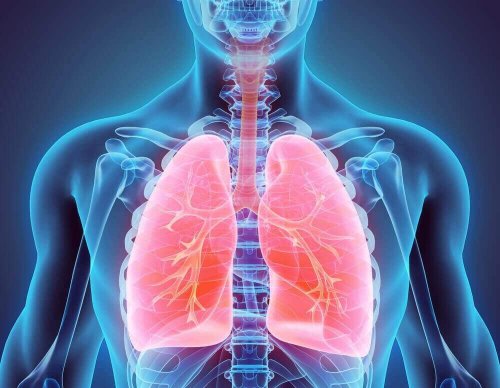 Natuurlijke remedies om bronchiëctasie te bestrijden