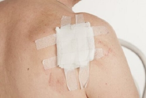 Oorzaken en preventie van huidkanker