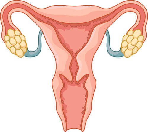 Polycysteus-ovariumsyndroom