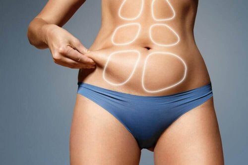 Rectus diastase: hoe kun je het herstellen?