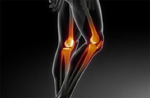 Start de preventie van osteoporose zo snel mogelijk