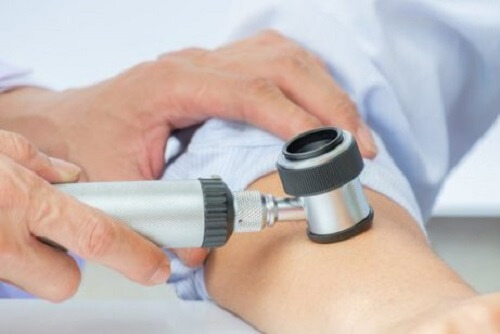 Vormen van huidkanker