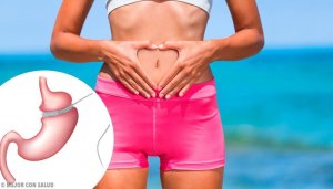 Voordelen en bijwerkingen van een maagverkleining