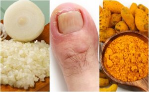 Maak zelf deze 6 remedies voor een ontstoken nijnagel