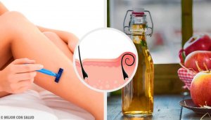 5 natuurlijke middelen tegen huidirritatie na het scheren